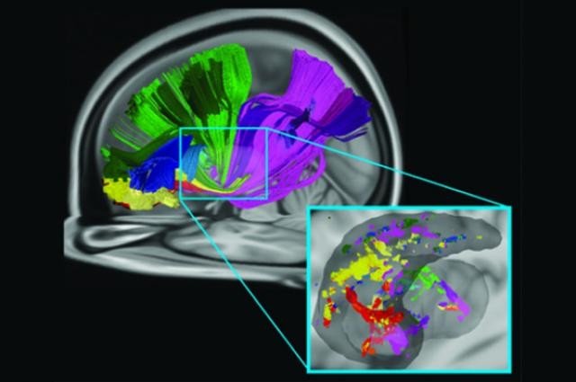 Обнаружены новые связи в мозгу, отвечающие за ориентирование в пространстве