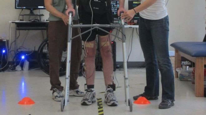 Устройство для чтения сигналов мозга позволило парализованному ходить
