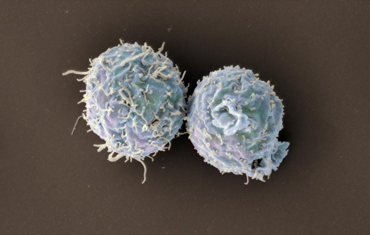 Новый метод редактирования T-клеток останавливает отторжение организмом пересаженного органа