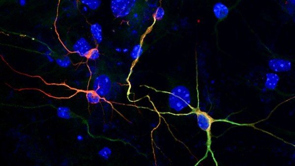 Клетки кожи превратили в нейроны химическим путем