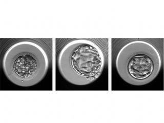 ИИ помогает определить количество хромосом у эмбриона, оплодотворённого с помощью ЭКО