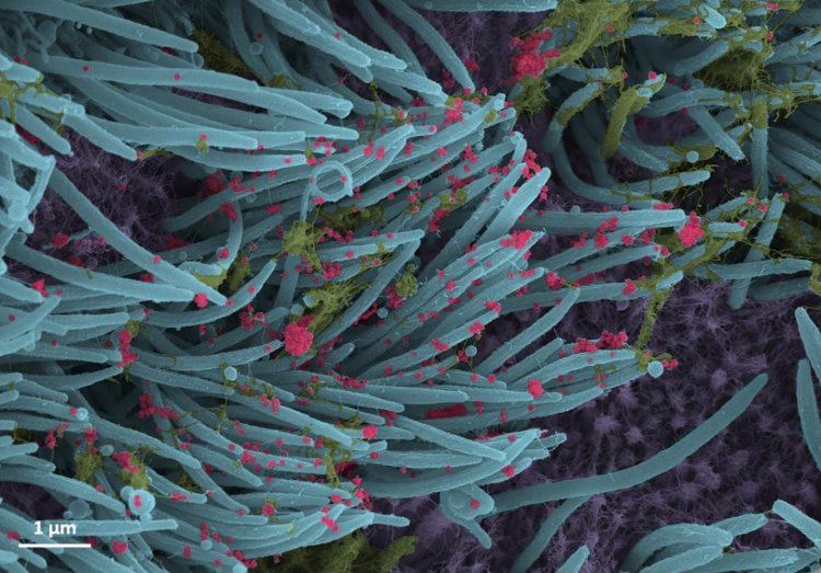 Ученые получили микроскопические фото клеток, инфицированных SARS-CoV-2