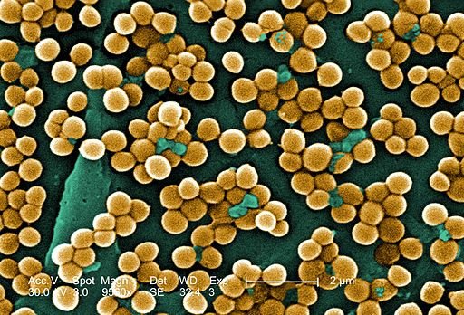 Бактерии могут перехитрить антибиотики