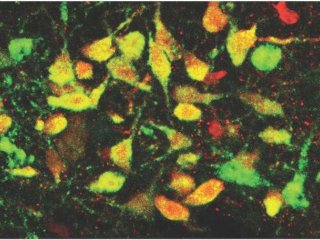 Изображение дорсальной рапы, области, расположенной в стволе мозга, показывает серотонинергические нейроны зеленым цветом, вирусно экспрессированный белок TdTomato - красным, а колокализованные клетки - желтым. Лаборатория Спитцера