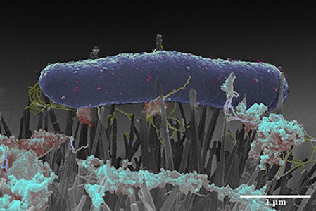 В крыльях насекомых содержатся наноструктуры, убивающие бактерии