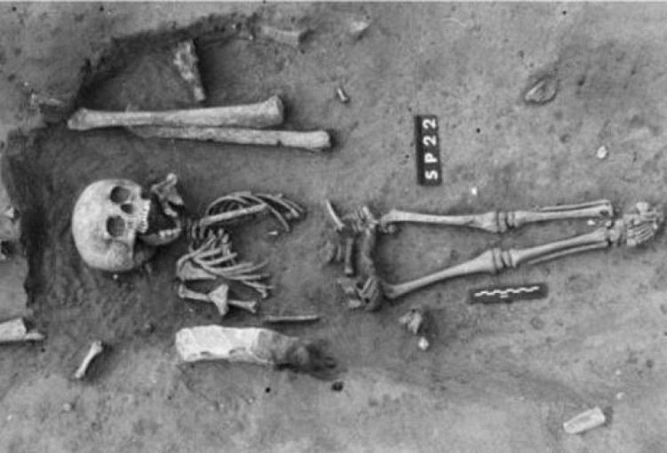 Найден древнейший скелет человека с синдромом Дауна