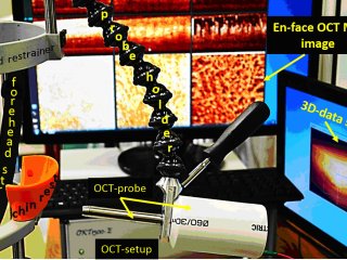 В ИПФ РАН создан мультимодальный оптический когерентный томограф для визуализации микрокровотока