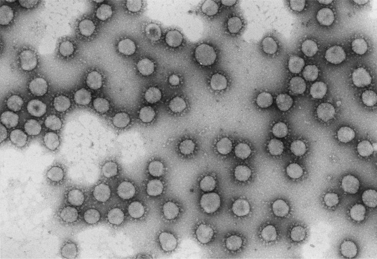 Так выглядит очищенный коронавирус. Источник иллюстрации: CNB-CSIC. MADRID. Acad. Luis Enjuanes.