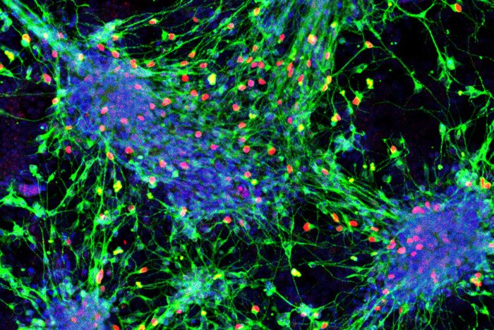 Как превратить стволовые клетки в сенсорные интернейроны: ученые разработали схему 