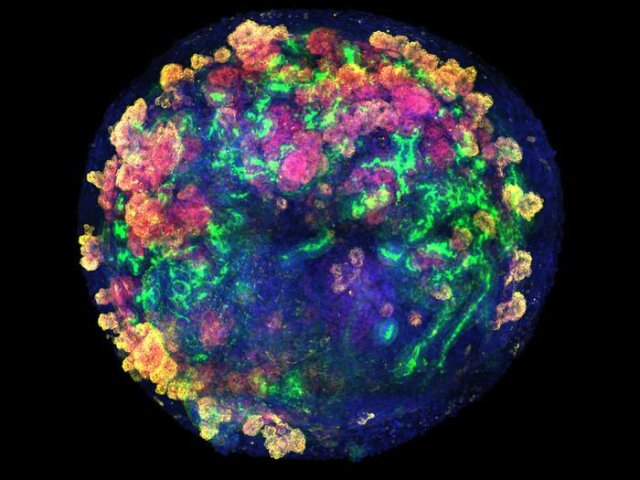 Микроскопическое изображение органоида почки на 16-й день. Клетки были помечены разными цветами с помощью иммунофлуоресценции для идентификации компонентов. Фото: Institute for Bioengineering of Catalonia / Núria Montserrat