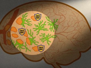 Исследование выявило два белка, которые используют раковые клетки, чтобы избежать уничтожения микроглией при первом попадании в мозг. Фото: Kano Okada, Nagoya University