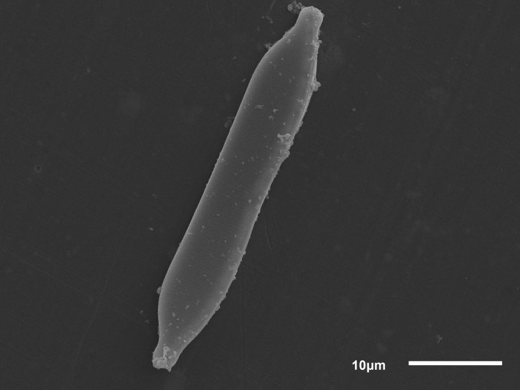 Микрофотография панциря диатомовых водорослей рода Hantzschia с наружной стороны. Фото сделано с помощью электронного микроскопа. Масштаб — 10 микрометров.