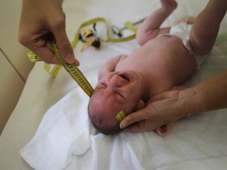 Миру грозит эпидемия микроцефалии