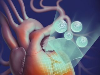 Австралийские ученые напечатали на 3D-принтере «заплатки» на сердце