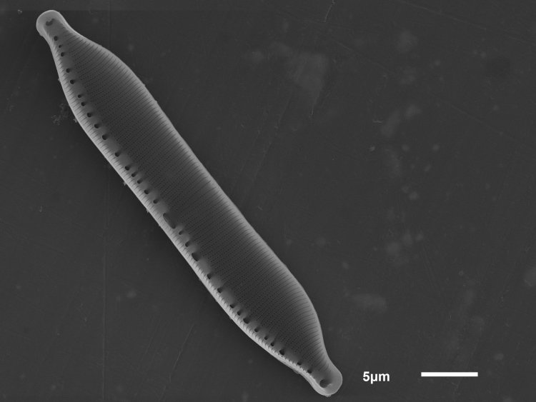 Микрофотография панциря диатомовых водорослей рода Hantzschia с внутренней стороны. Фото сделано с помощью электронного микроскопа. Масштаб — 5 микрометров.