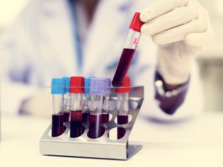 Новый анализ крови позволяет быстро диагностировать тысячи редких генетических заболеваний. Фото: ru.123rf.com