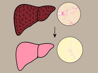 Лечение хной превращает печень с фиброзом в здоровую печень. Фото: Osaka Metropolitan University / Tsutomu Matsubara