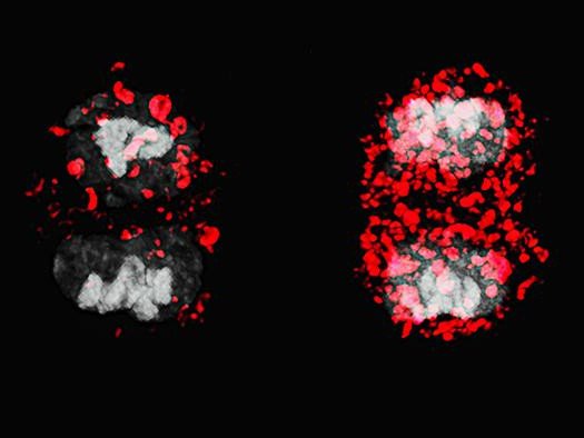 Стволовые Т-клетки обычно подвергаются асимметричному делению (слева), в результате которого одна дочерняя клетка становится долгоживущей Т-клеткой памяти. Фото: University of Oxford / Mariana Borsa