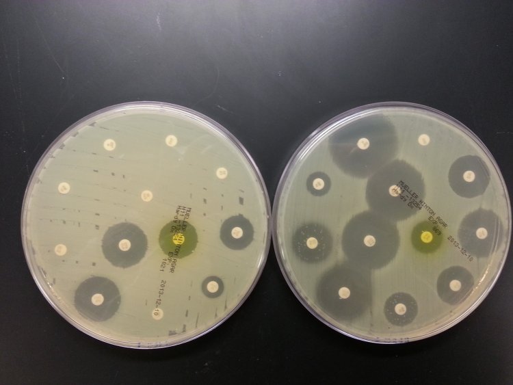 Устойчивость бактерий к антибиотикам растет