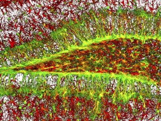 Стволовые клетки мозга обновляются ограниченно