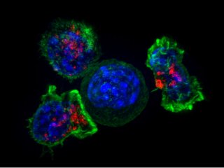 Длина ресничек раковых клеток определяет их сопротивляемость лекарствам