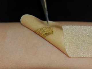 Новые биосенсоры могут контролировать процесс заживления ран на коже