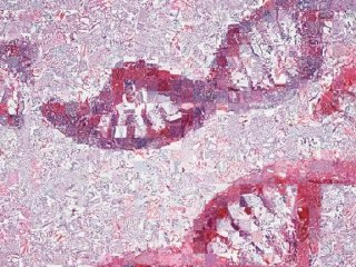 ИИ научили определять более 160 моделей мутаций в ДНК раковой опухоли