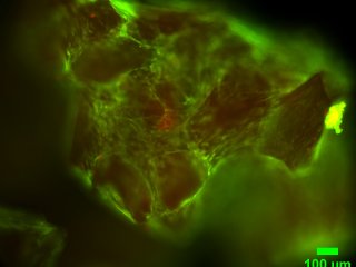 Микрофотографии структуры поверхности клеточно-инженерной конструкции, состоящей из децеллюляризованного суставного хряща свиньи и МСК ЖТч. Окрашивание флуоресцентным красителем LIVE/DEAD. В зеленый цвет окрашены живые клетки, а в красный — мертвые клетки