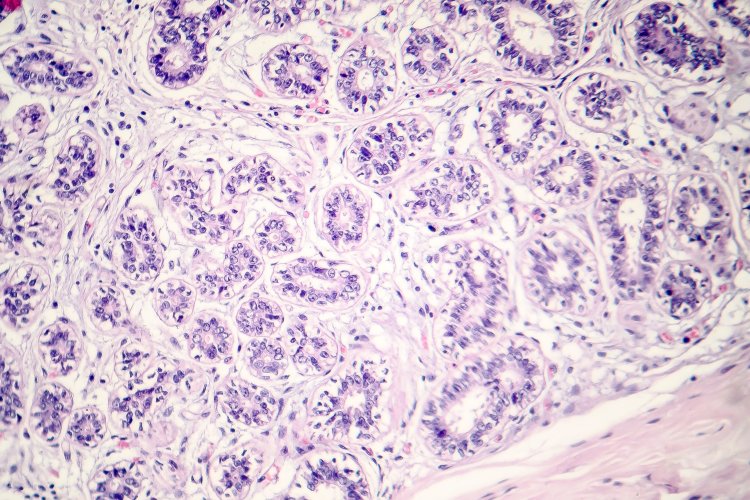 Световая нанотехнология обеспечит точное и менее вредное лечение рака. Фото: ru.123rf.com