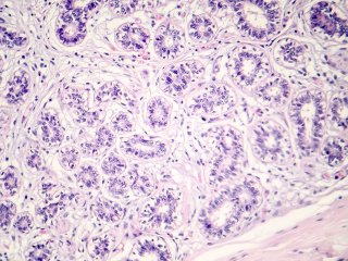 Световая нанотехнология обеспечит точное и менее вредное лечение рака. Фото: ru.123rf.com