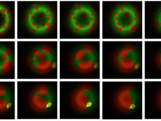 Микобактерии выработали сложные способы захвата иммунных клеток человека и предотвращения их разрушения. Они укрепляют внутреннюю мембрану, чтобы пищеварительные ферменты в лизосомах не могли убить бактерии. Фото: Ayush Panda / Biophysical Society