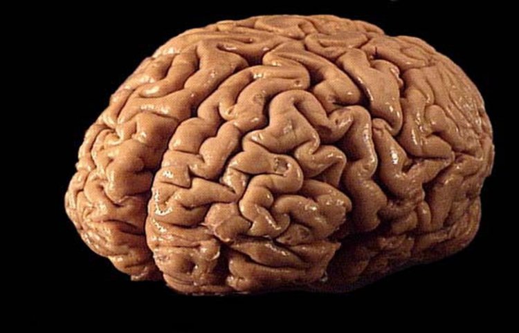 Обнаружен участок мозга, ответственный за уникальность человека