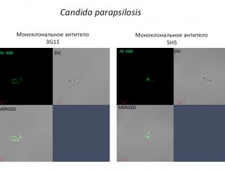 В ИХБФМ СО РАН синтезировали белковые препараты для лечения системного кандидоза