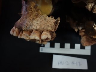 Low-Res_upper jaw. JPG