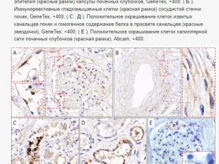 Российскими учеными описан механизм распространения  COVID-19 из легких в другие органы