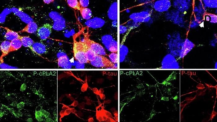 Команда проанализировала миллиарды потенциальных молекул, отдав предпочтение тем, которые, по прогнозам, будут избирательными, проникающими в мозг и активными в биологически значимых условиях. Фото: Image/USC / Hussein Yassine