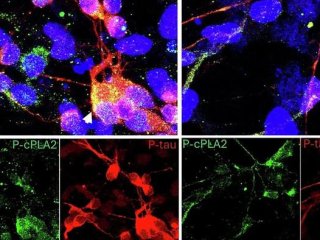 Команда проанализировала миллиарды потенциальных молекул, отдав предпочтение тем, которые, по прогнозам, будут избирательными, проникающими в мозг и активными в биологически значимых условиях. Фото: Image/USC / Hussein Yassine