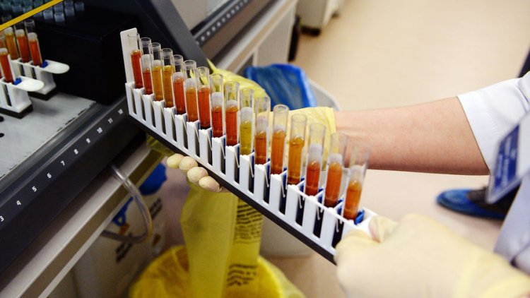 Биохимики&nbsp; ИХБФМ СО РАН раскрыли секрет возникновения аутоиммунных заболеваний