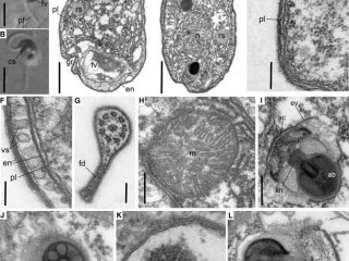 Морфология и ультраструктура Ancoracysta twista. Источник: Janouškovec J, Tikhonenkov D, Burki F ... A New Lineage of Eukaryotes Illuminates Early Mitochondrial Genome Reduction Current Biology, 2017; 27, 3717-3724.e5