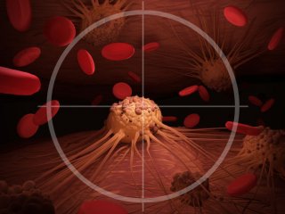 Ученые взломали защитный механизм стволовых клеток лейкемии