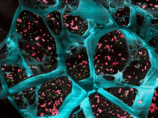 Биоразлагаемый гель усиливает атаку иммунной системы на рак у мышей