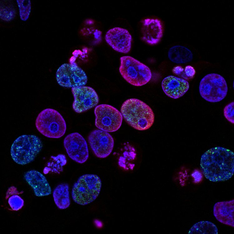 Нанотермометр для живых тканей и клеток. Источник: National Cancer Institute / Фотобанк Unsplash