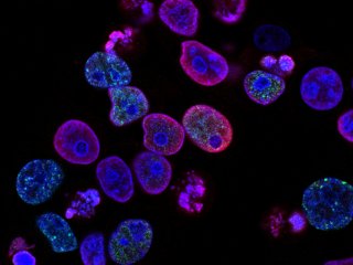 Нанотермометр для живых тканей и клеток. Источник: National Cancer Institute / Фотобанк Unsplash