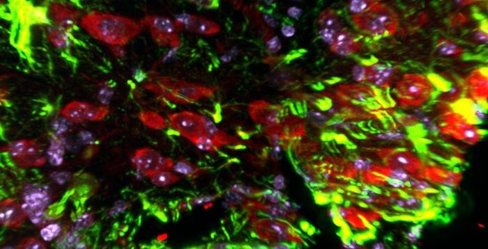 Сверхэкспрессия улитки In vivo (красная) в клетках микроглии/макрофагов в поврежденной коре головного мозга. Реактивные астроциты помечены зеленым цветом по краям повреждения.