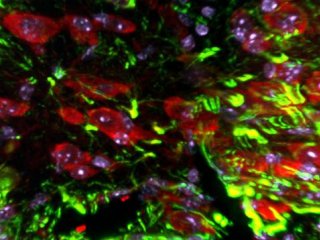 Сверхэкспрессия улитки In vivo (красная) в клетках микроглии/макрофагов в поврежденной коре головного мозга. Реактивные астроциты помечены зеленым цветом по краям повреждения.