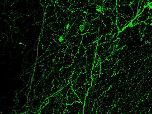 Нейроны, вырабатывающие CRF, в префронтальной коре головного мозга, наблюдаемые под флуоресцентным микроскопом. Фото: Francesco Papaleo / IIT-Istituto Italiano di Tecnologia