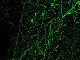 Нейроны, вырабатывающие CRF, в префронтальной коре головного мозга, наблюдаемые под флуоресцентным микроскопом. Фото: Francesco Papaleo / IIT-Istituto Italiano di Tecnologia