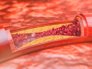 Изображение: crevis/Фотобанк RU.123.RF