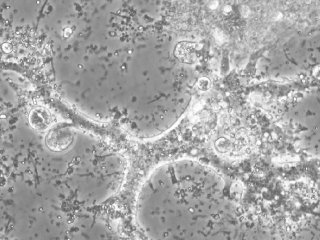 Световая микроскопия Leptomyxa silvatica