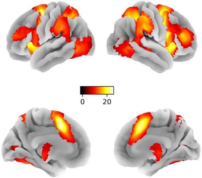 Карты активации мозга для общего подавления реакции на уровне всего мозга (контраст: NoGo > Go; P < 0,05 FWE, пиковый уровень). L, слева; R, справа. Цветовая полоса представляет t-значения сигнала, выделенного жирным шрифтом, и отражает уровень значимости